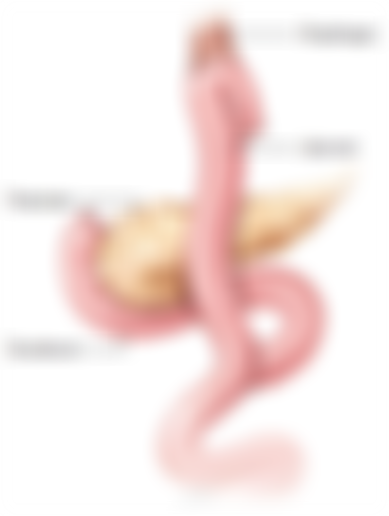 Total Gastrectomy with Roux En Y and Jejunal Pouch Reconstruction Enlarged